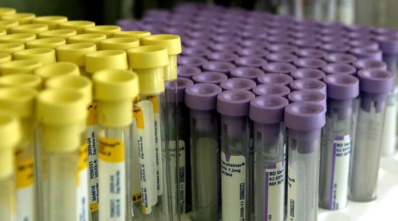 The city of Fairfield is the second community in Butler County to offer a bloodborne pathogen prevention program. There are multiple informational meetings, including for Thursday night. Photo: Lucas Cannistraci