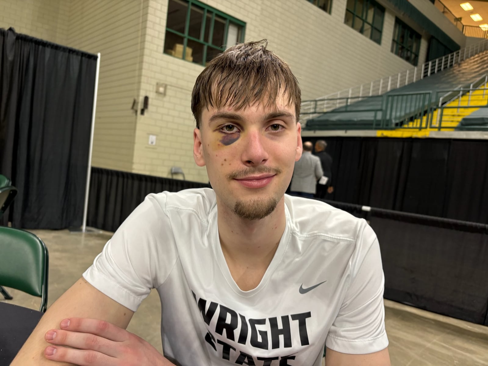 Wright State University freshman Kellen Pickett shows off his black eye after their game against IU Indy on Thursday, Feb. 19, 2026. TOM ARCHDEACON / CONTRIBUTED PHOTO