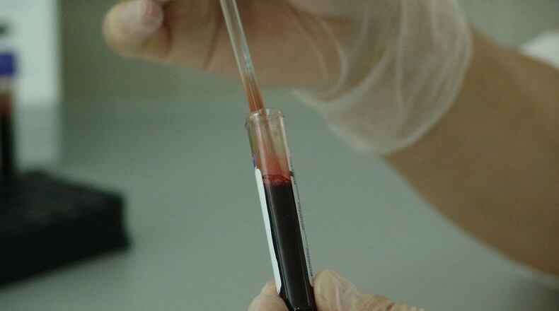 Lab testing of a blood sample is pictured here. Photo: Pixabay