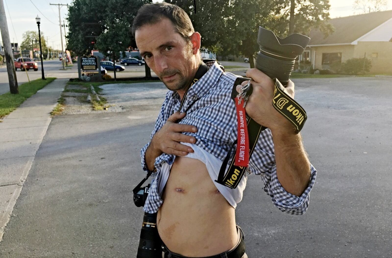 New Carlisle News photographer Andy Grimm on Friday, Oct. 20, 2017, shows where a bullet went in through his torso and out the side while on the scene of an accident. He was shot around 2 a.m. Sept. 4 when a Clark County Sheriff's deputy said he mistook Grimm's camera for a gun.