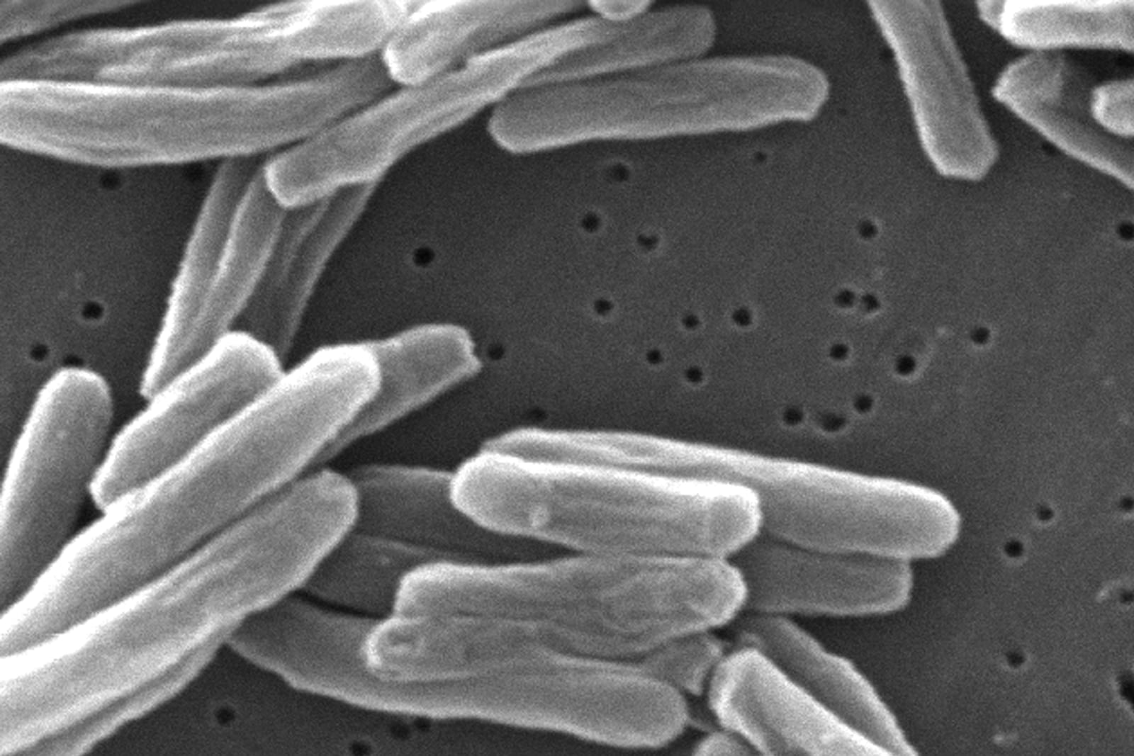 FILE - This 2006 electron microscope image provided by the Centers for Disease Control and Prevention shows Mycobacterium tuberculosis bacteria, which causes the disease tuberculosis. (Janice Carr/CDC via AP)