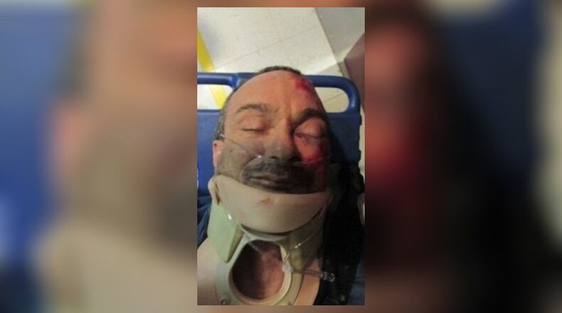 Joseph Guglielmo is shown in a neck brace after he allegedly was beaten by a Montgomery County Jail sergeant in January 2015. A lawsuit filed by Guglielmo is scheduled to go to trial in June.