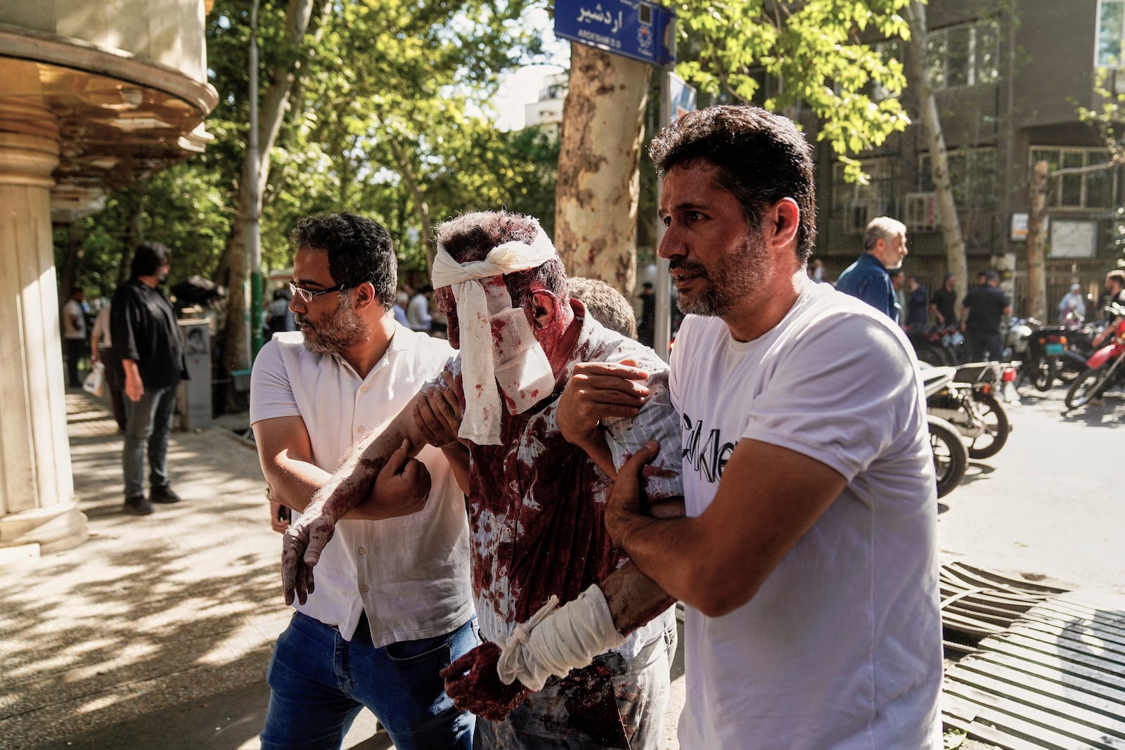 An injured man is helped to leave the scene after an explosion in downtown Tehran, amid Israel's two-day campaign of strikes against Iran, Sunday, June 15, 2025. (AP Photo/Amir Kholousi/ISNA)