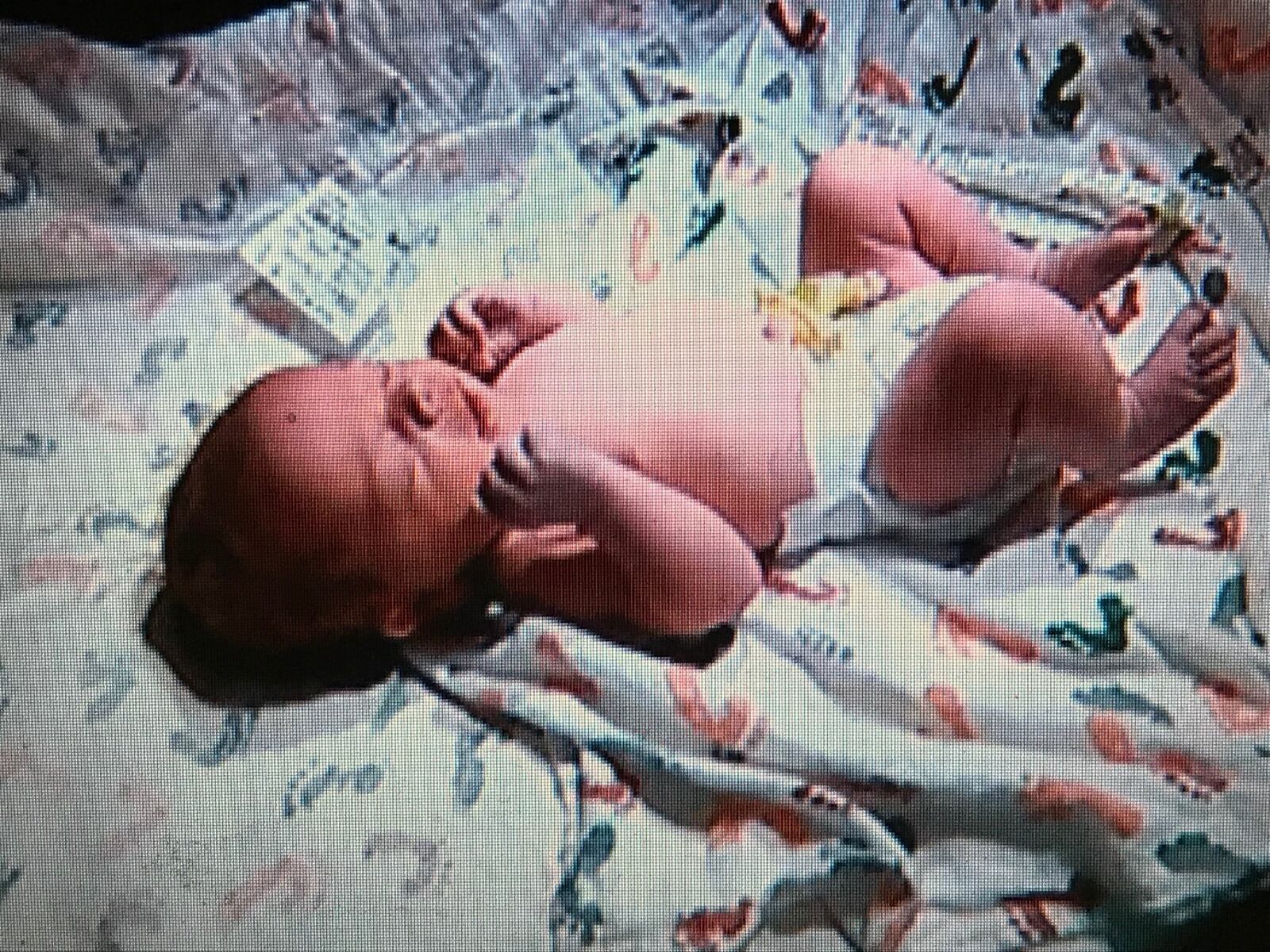 Family provided this photo of Marlie Hennon, which was taken right after his delivery two weeks ago. CONTRIBUTED PHOTO
