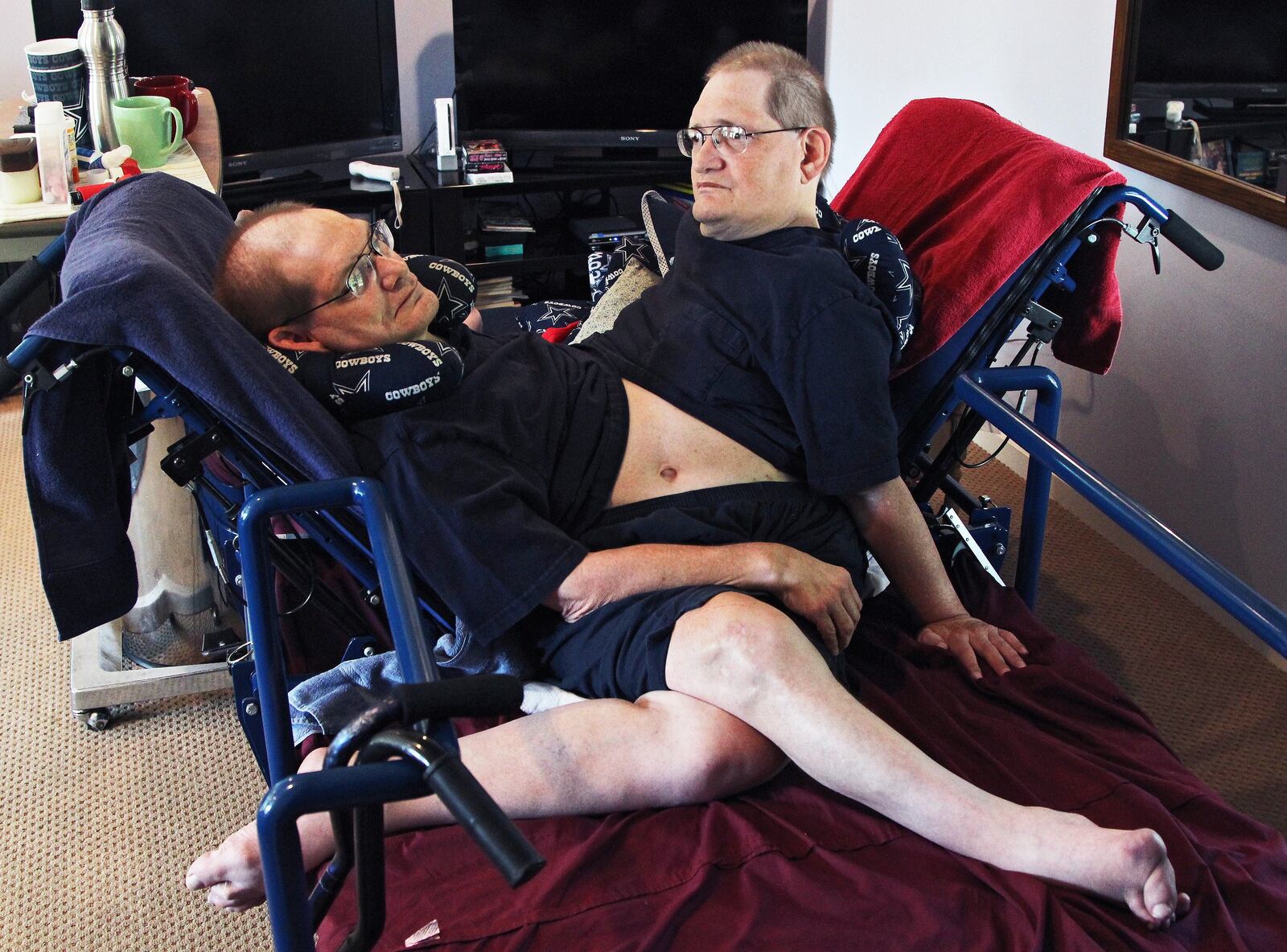 Donnie and Ronnie Galyon are nearing the record for longest living conjoined twins. The Galyons, born October 28, 1951 at St. Elizabeth Hospital in Dayton, now live in Beavercreek with their brother, Jim Galyon and his wife Mary, who provide 24-7 care for them.  DREW SIMON / STAFF