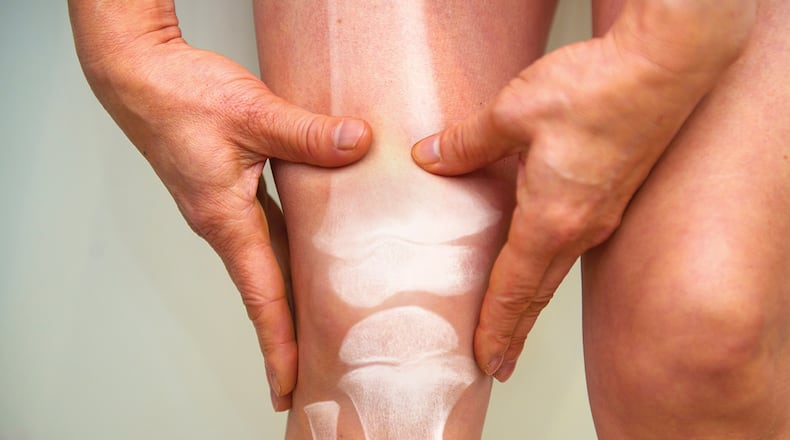 The National Institute on Aging says osteoporosis is a “silent disease” because people who develop it may not notice any changes until a bone breaks. METRO NEWS SERVICE