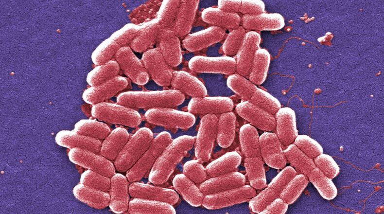 This colorized scanning electron micrograph image made available by the Centers for Disease Control and Prevention shows a strain of the E. coli bacteria. (Janice Carr/CDC via AP)