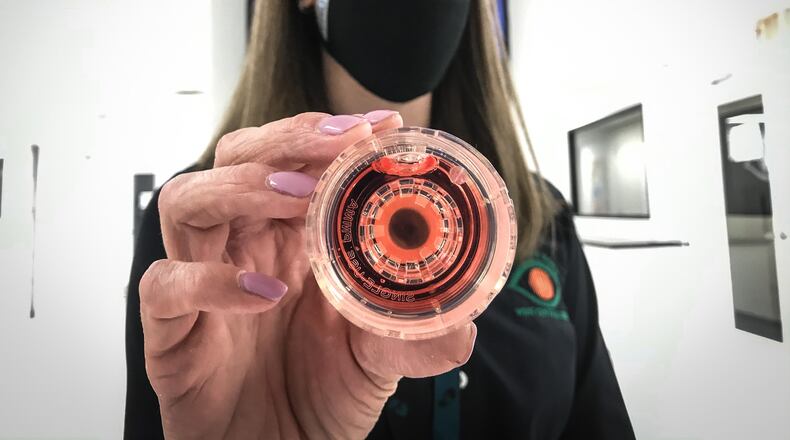 Shannon Price-Schweitzer, executive director of Lions Eye Bank of West Central Ohio, holds up a donated cornea. JIM NOELKER/STAFF