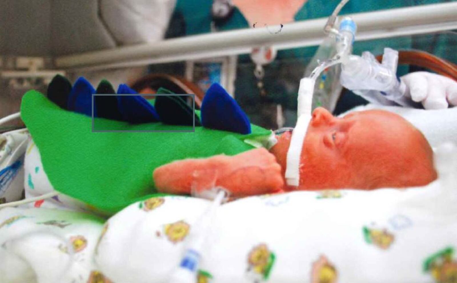 A Halloween event  was held for babies in the Miami Valley Hospital Neonatal Intensive Care Unit (NICU) and their siblings and parents. Nurses and other hospital staff members wore costumes as did the babies. Photo: Miami Valley Hospital
