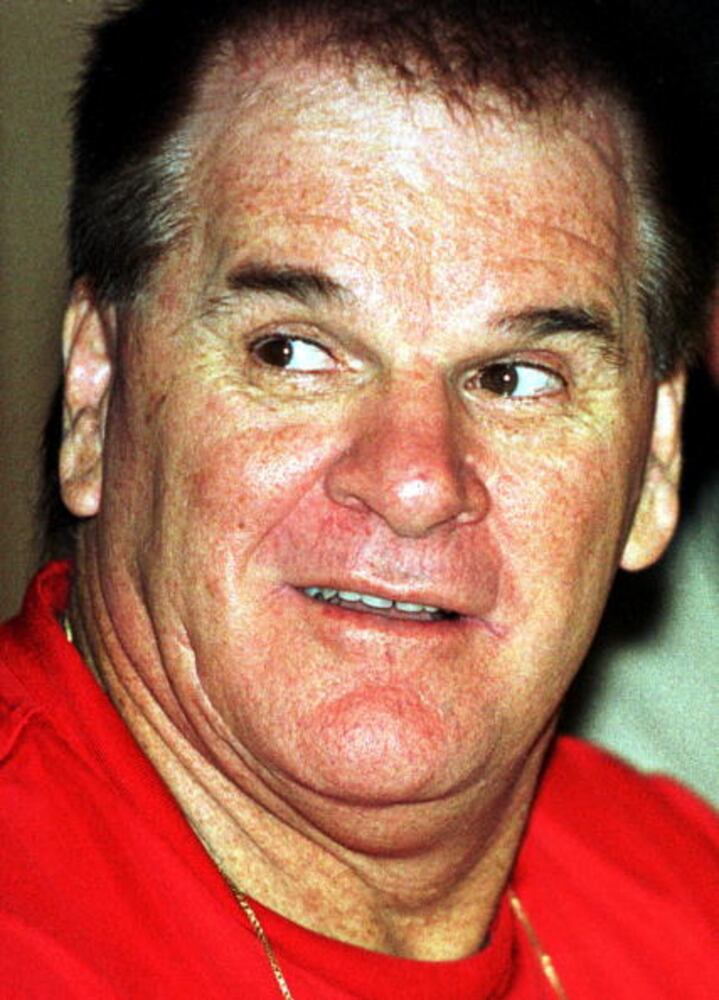 Getting suit ‘stolen’ by Pete Rose