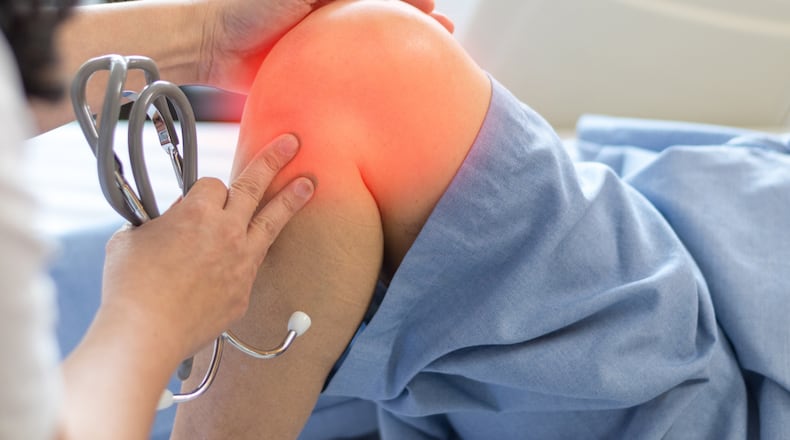 According to the American College of Rheumatology, about 790,000 knee replacements are done every year. iSTOCK/COX