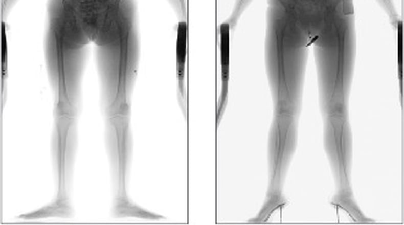 OD Security, the manufacturer for the Full Body Security Scanning System, provides an example of a scanned body image. OD SECURITY NORTH AMERICA