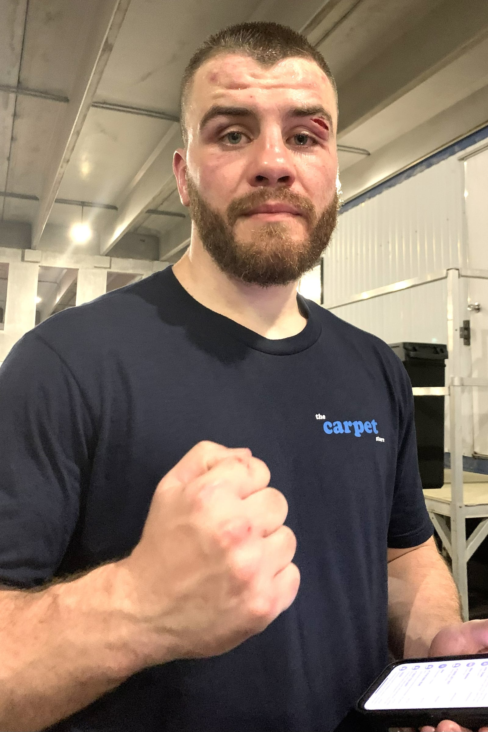 Sam Wildendaus, known in the ring as “Sammy the Bull” after a rugged victory that left a gash above his left eye. This Saturday night, the 27-year-old Yellow Springs super middleweight who is 13-4 as a pro, meets bareknuckle and MMA fighter Vo Van in the main event exhibition bout at the Knockout 25 show at the Dayton Convention Center. CONTRIBUTED PHOTO