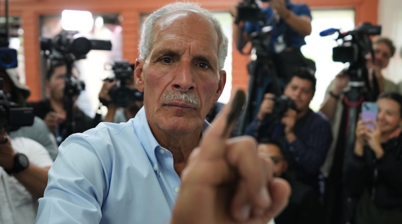 Nasry Asfura, presidential candidate for the National Party, shows his inked finger afterv voting in general elections in Tegucigalpa, Honduras, Sunday, Nov. 30, 2025. (AP Photo/Moises Castillo)