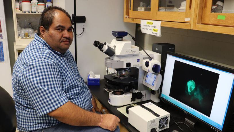 University of Dayton biologist Amit Singh is studying early eye development in fruit flies under a grant from the National Institutes of Health. CONTRIBUTED